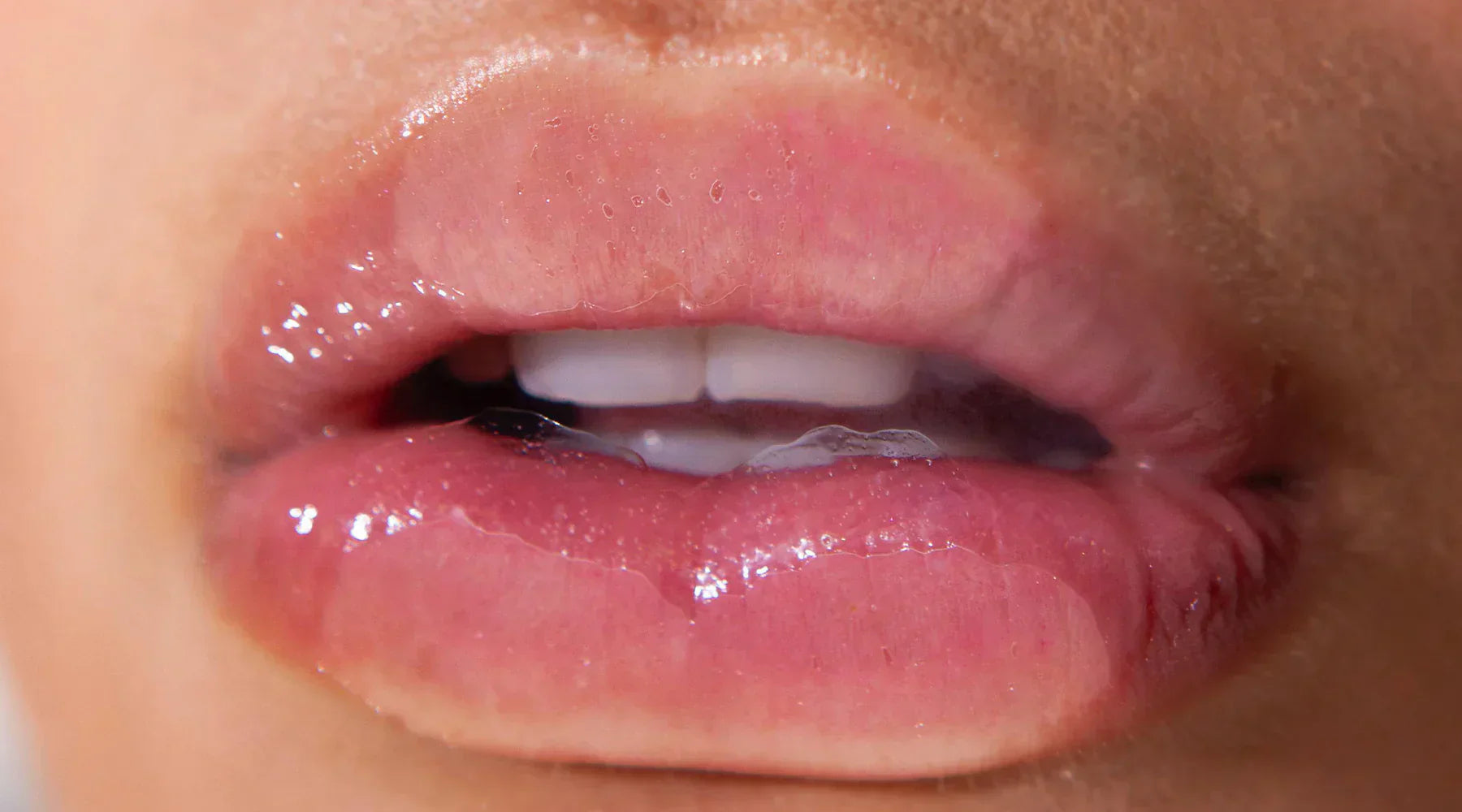 WET LIPS CUMPLE UN AÑO!!!!!  <3 <3